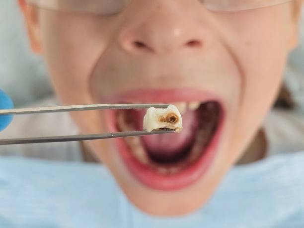 Best Pediatric Emergency Dentist in Piedmont, SD